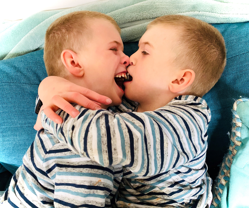 Alex e Dylan, due gemelli con una sindrome genetica da poco scoperta, la BIS