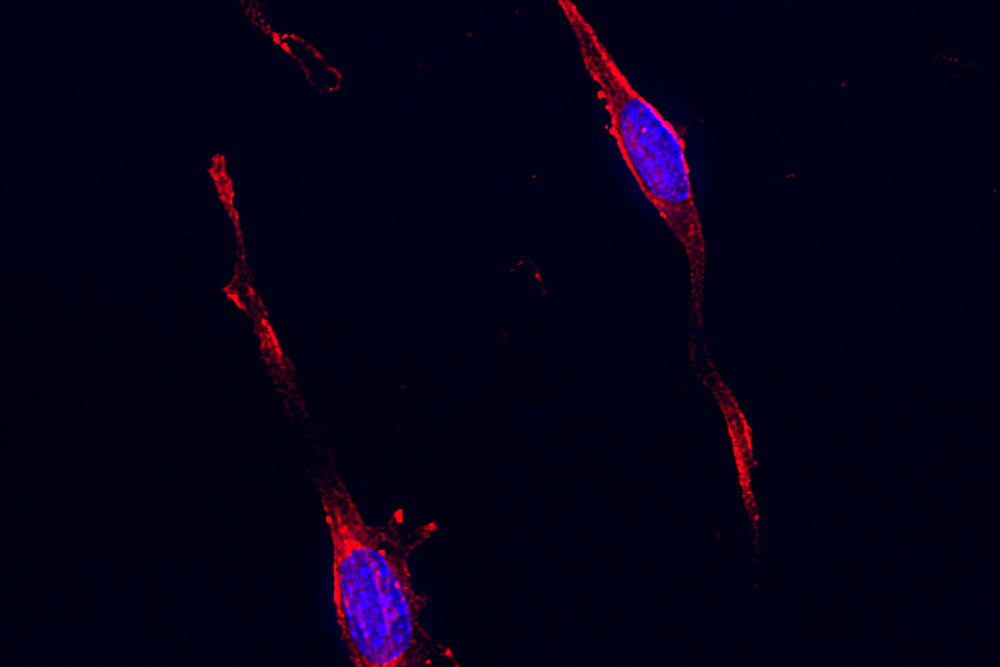 precurosi di neuroni al microscopio